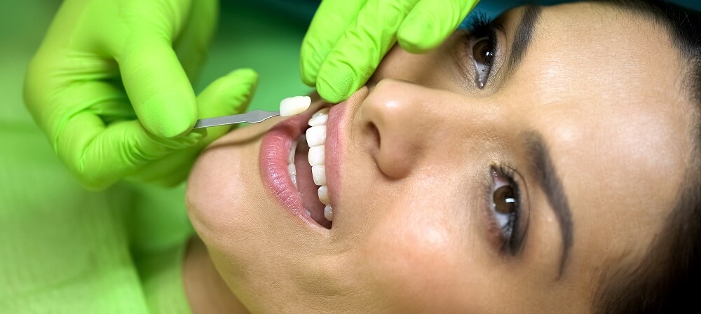 Porcelain Dental Veneers Procedure, Benefits, Costs