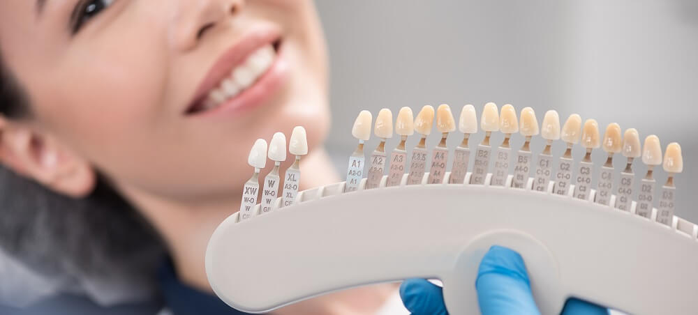 Porcelain Dental Veneers Procedure, Benefits, Costs