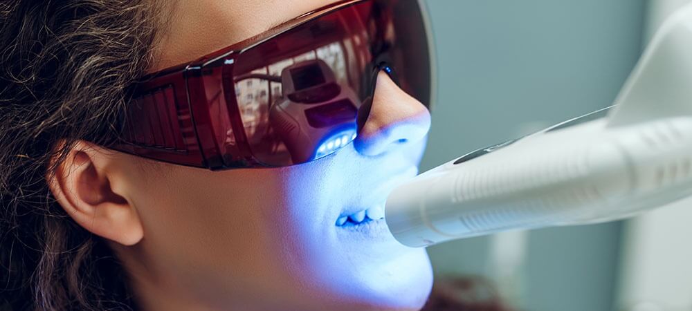 cost of teeth whitening at a dentist