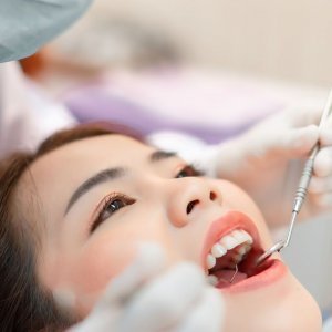 teeth whitening dentist cost