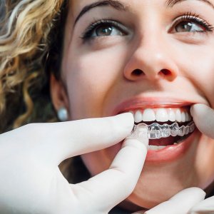 science of straight teeth