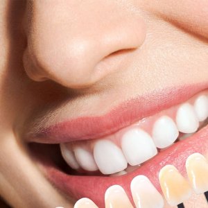 cosmetic dentistry in thornhill