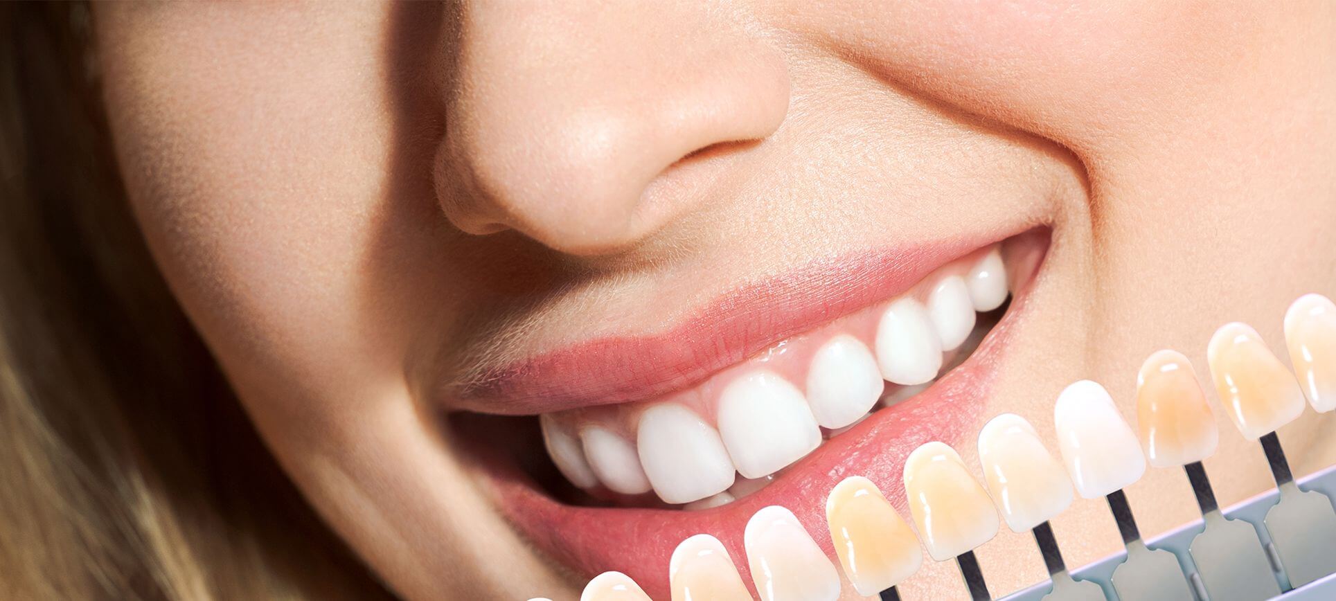 cosmetic dentistry in thornhill